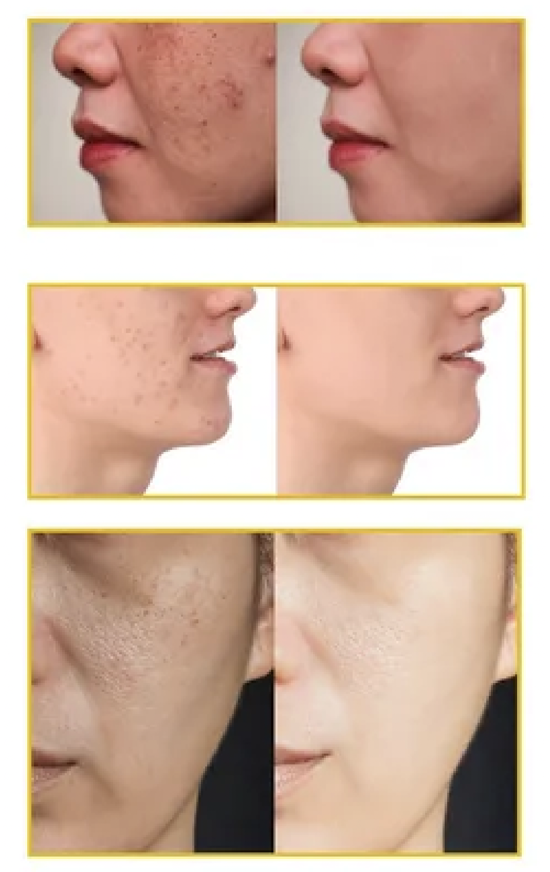 Jabón de cúrcuma piel mas suave 🧼🫧 2x1